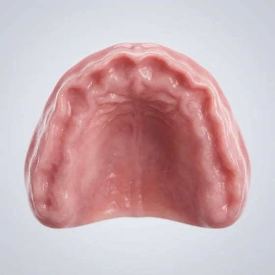 A toothless upper jaw ridge