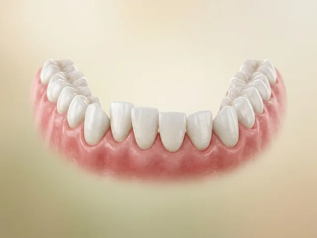 Crowded, crooked teeth before aligner treatment