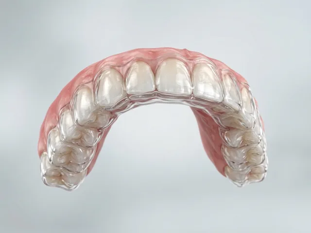 The night guard fitted over the teeth
