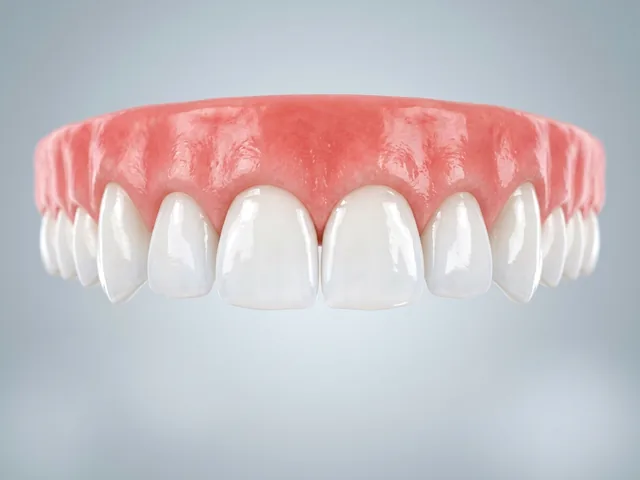 Dientes limpios y sanos después de una aplicación de flúor