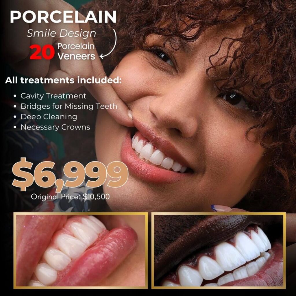 Just Smile - Porcelain Veneers Promo 6999