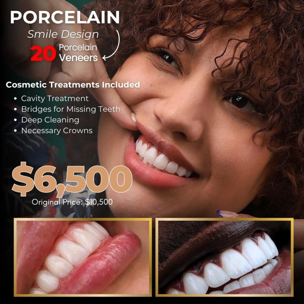 Porcelain Veneers - Special Offer in Just Smile Miami